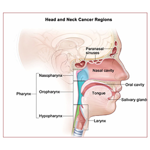 head and neck cancer treatment in Gujarat